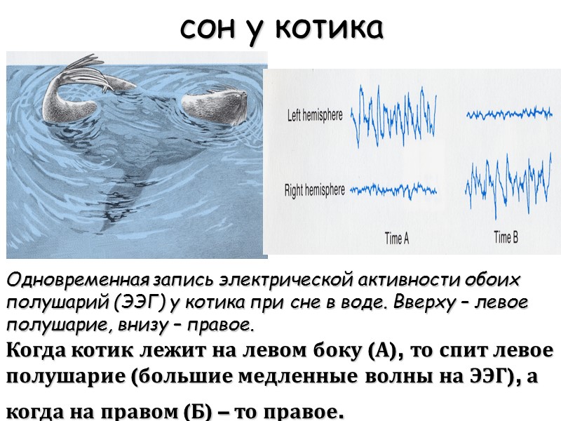 cон у котика Одновременная запись электрической активности обоих полушарий (ЭЭГ) у котика при сне